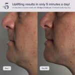 White upLift 5 Nano-Pulse anti-aging device with mouthpiece and power cord on a clean background.